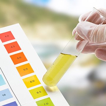 Rapid salmonella typhi IgG/IgM test strips